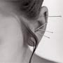 acupuntura